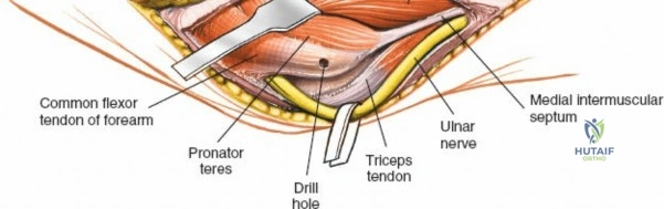 Clinical Image