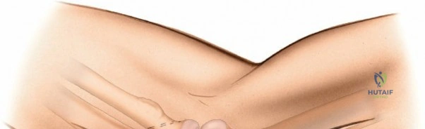 Clinical Image