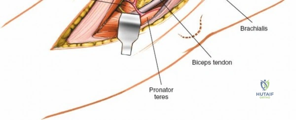 Clinical Image