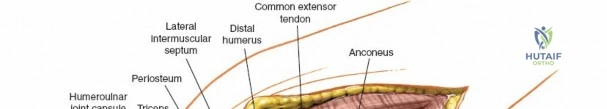 Clinical Image