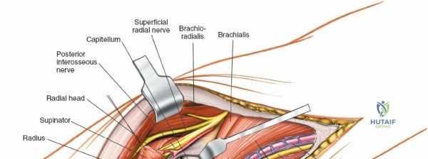 Clinical Image