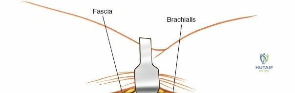 Clinical Image