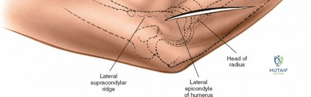 Clinical Image
