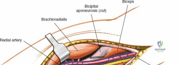 Clinical Image