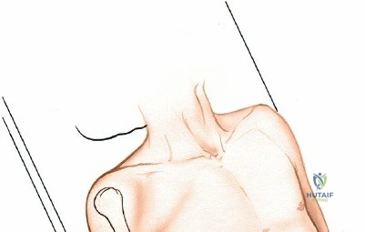 Clinical Image