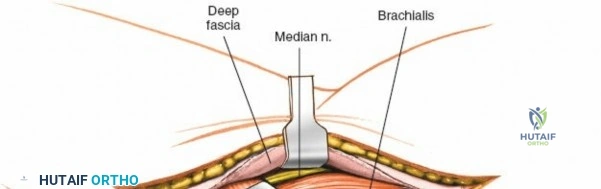 Clinical Image