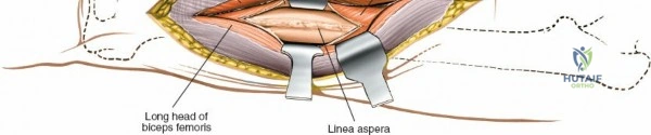 Clinical Image
