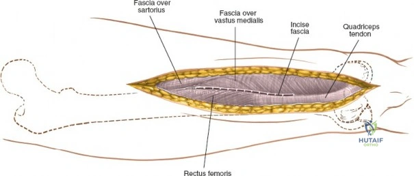 Clinical Image