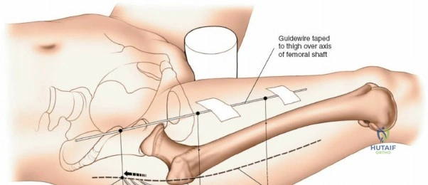 Clinical Image
