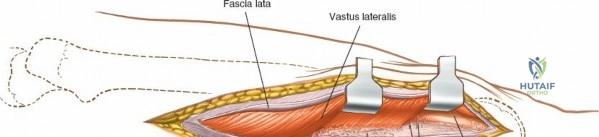 Clinical Image