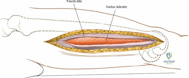 Clinical Image