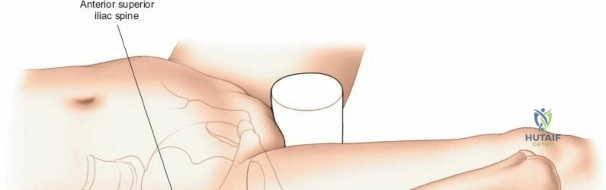 Clinical Image