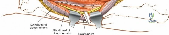Clinical Image
