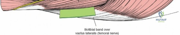 Clinical Image
