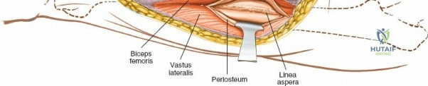 Clinical Image