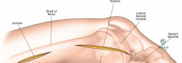 Clinical Image