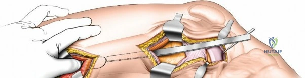 Clinical Image