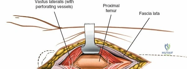 Clinical Image