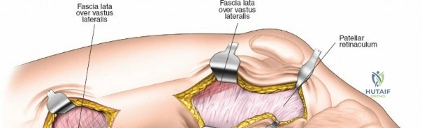 Clinical Image