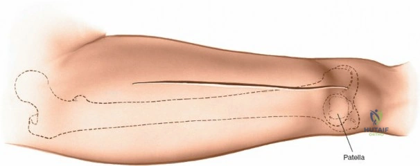 Clinical Image