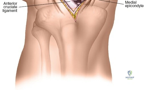 Clinical Image
