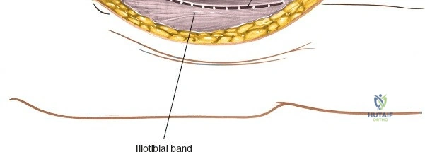Clinical Image