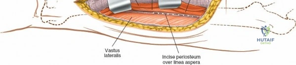 Clinical Image