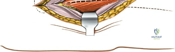 Clinical Image