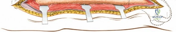 Clinical Image