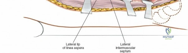 Clinical Image