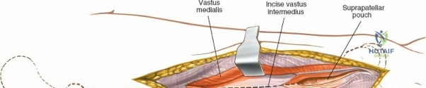 Clinical Image