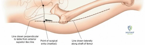 Clinical Image