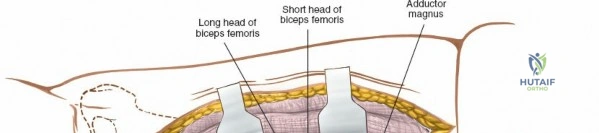 Clinical Image