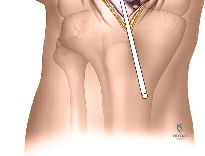 Clinical Image