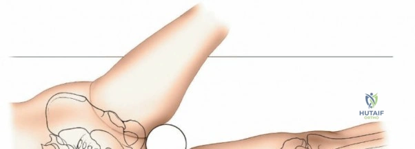 Clinical Image