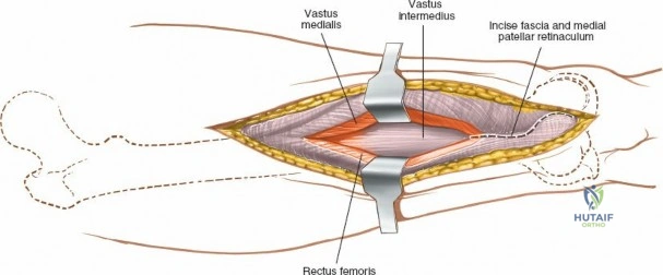 Clinical Image