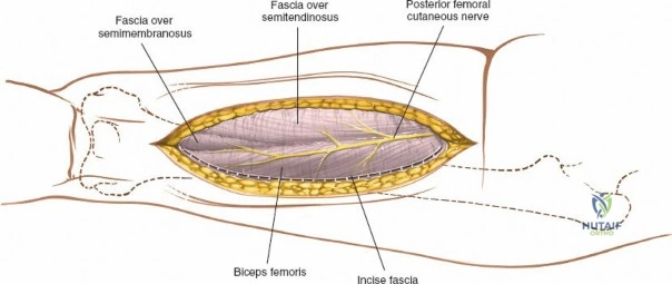 Clinical Image