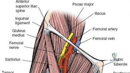 Clinical Image