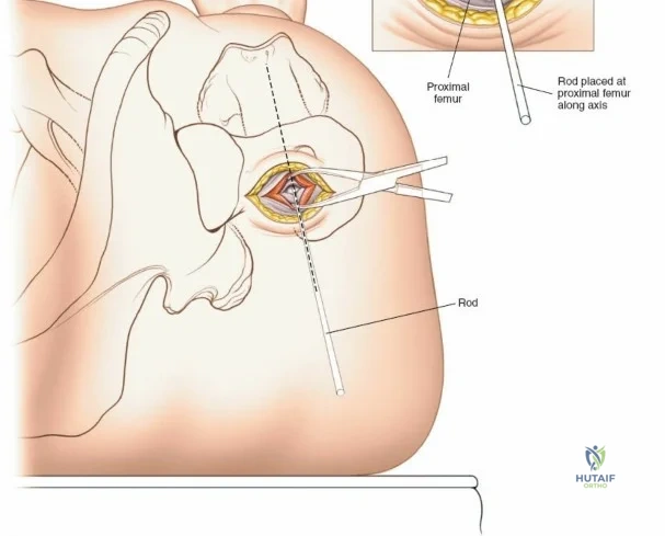 Clinical Image