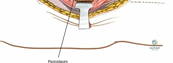 Clinical Image