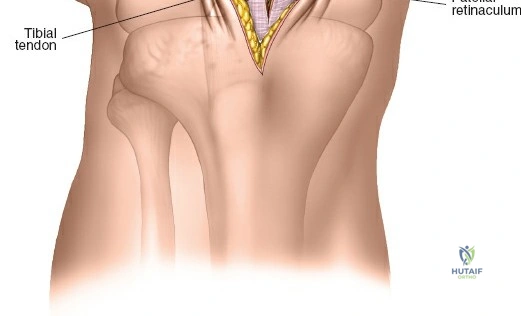 Clinical Image
