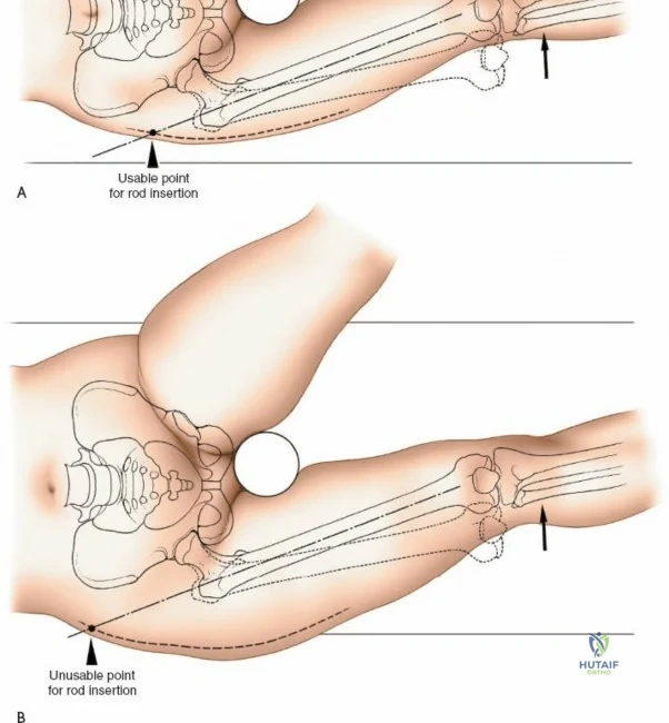 Clinical Image