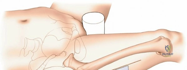 Clinical Image