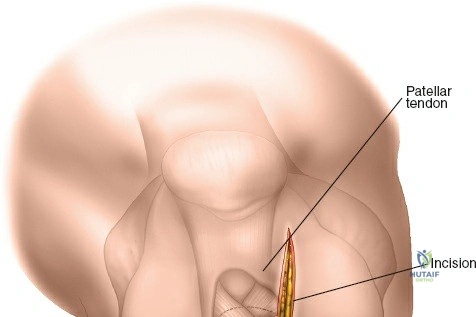 Clinical Image