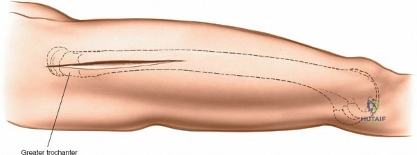 Clinical Image