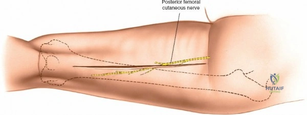 Clinical Image