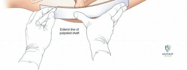 Clinical Image