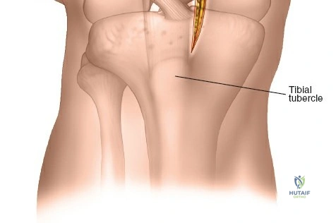 Clinical Image