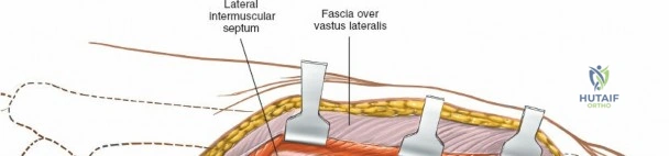 Clinical Image