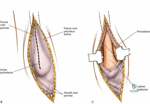 Clinical Image